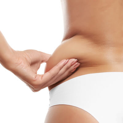 Bauchdeckenstraffung Bauchdeckenstraffung